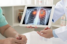 akcigere-pihti-atmasi-belirtileri