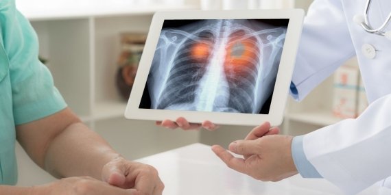 Akciğere Pıhtı Atması Belirtileri / Bu 14 İşarete Dikkat!