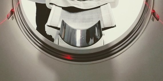 BT Nedir? Bilgisayarlı Tomografi Nasıl Yapılır?