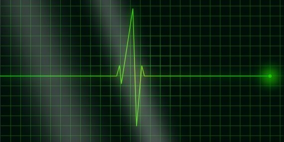 Kalp Pili Nedir, Nasıl Takılır? 3 Başlıkta Kalp Pili Tedavisi