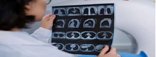 ilacli-tomografi