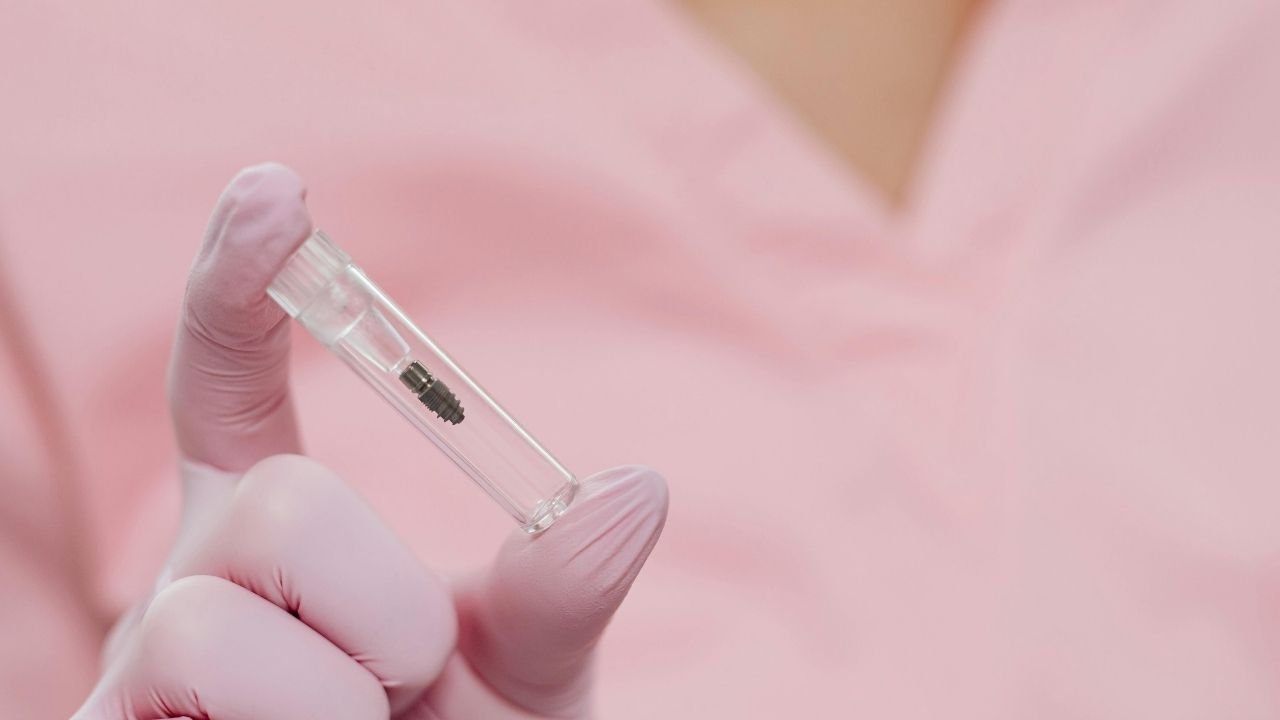 Çene İmplantı Fiyatları